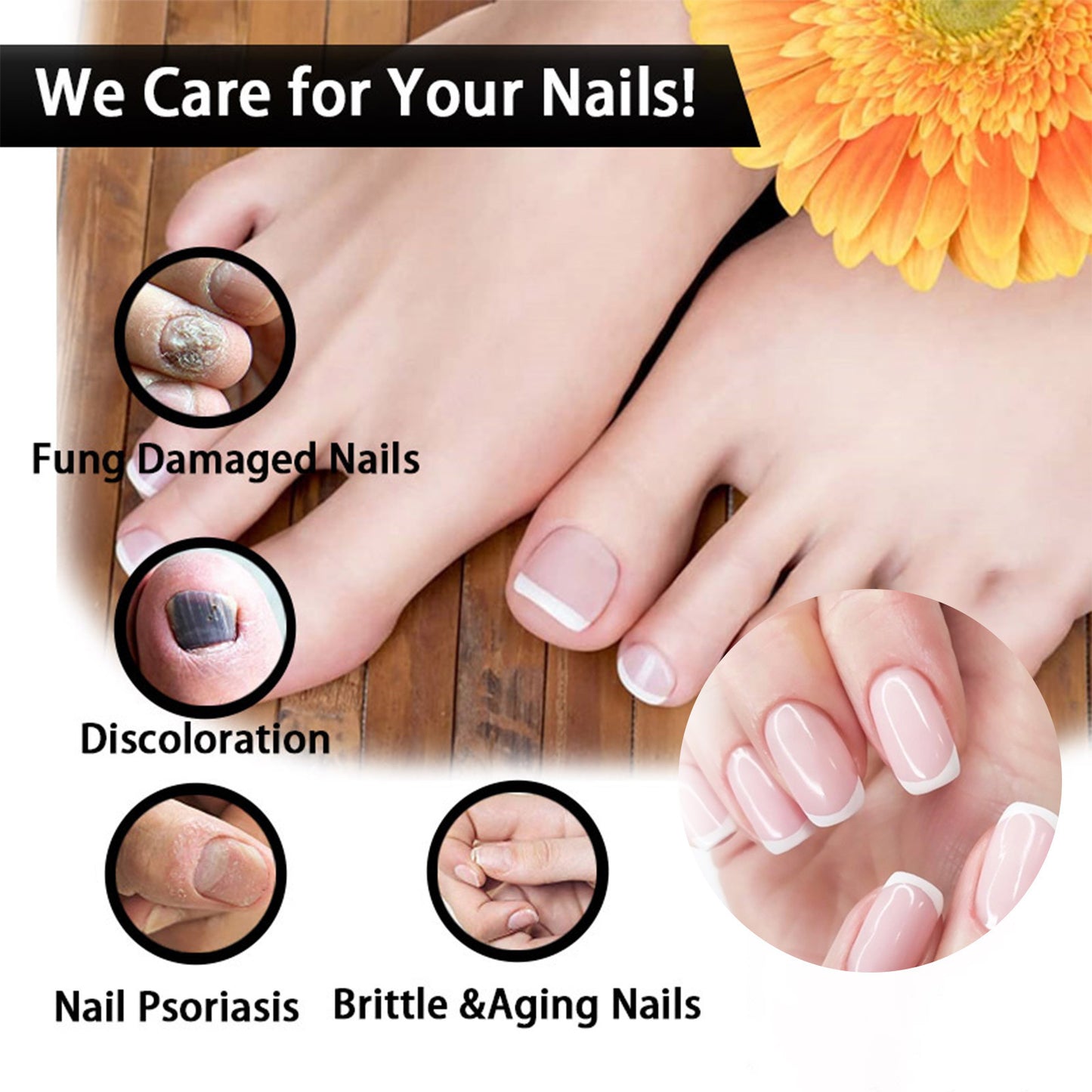 EELHOE Nail Repair Solution Thickening And Shining Nail Removal Dead Skin Repair