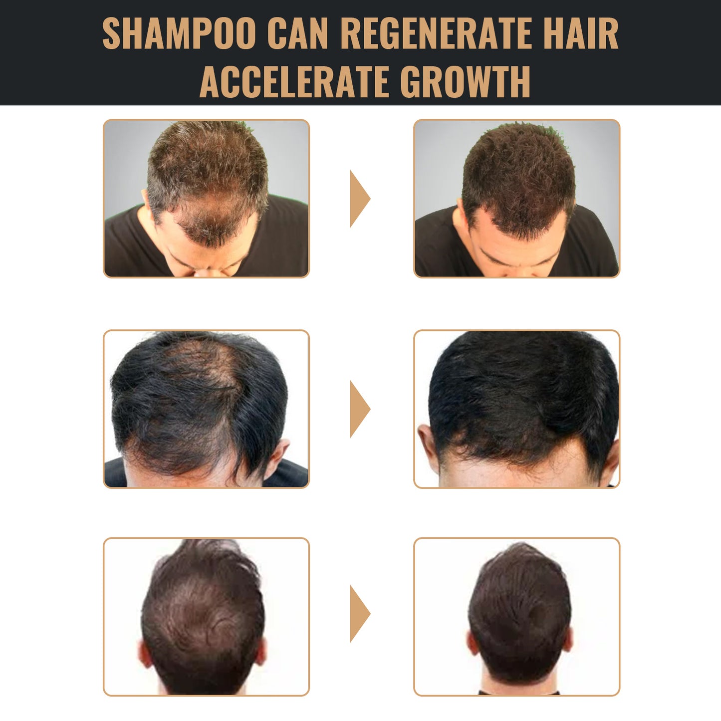 Root Activator Shampoo, Natural Hair Regrowth Shampoos, Unisex Hair Thickening