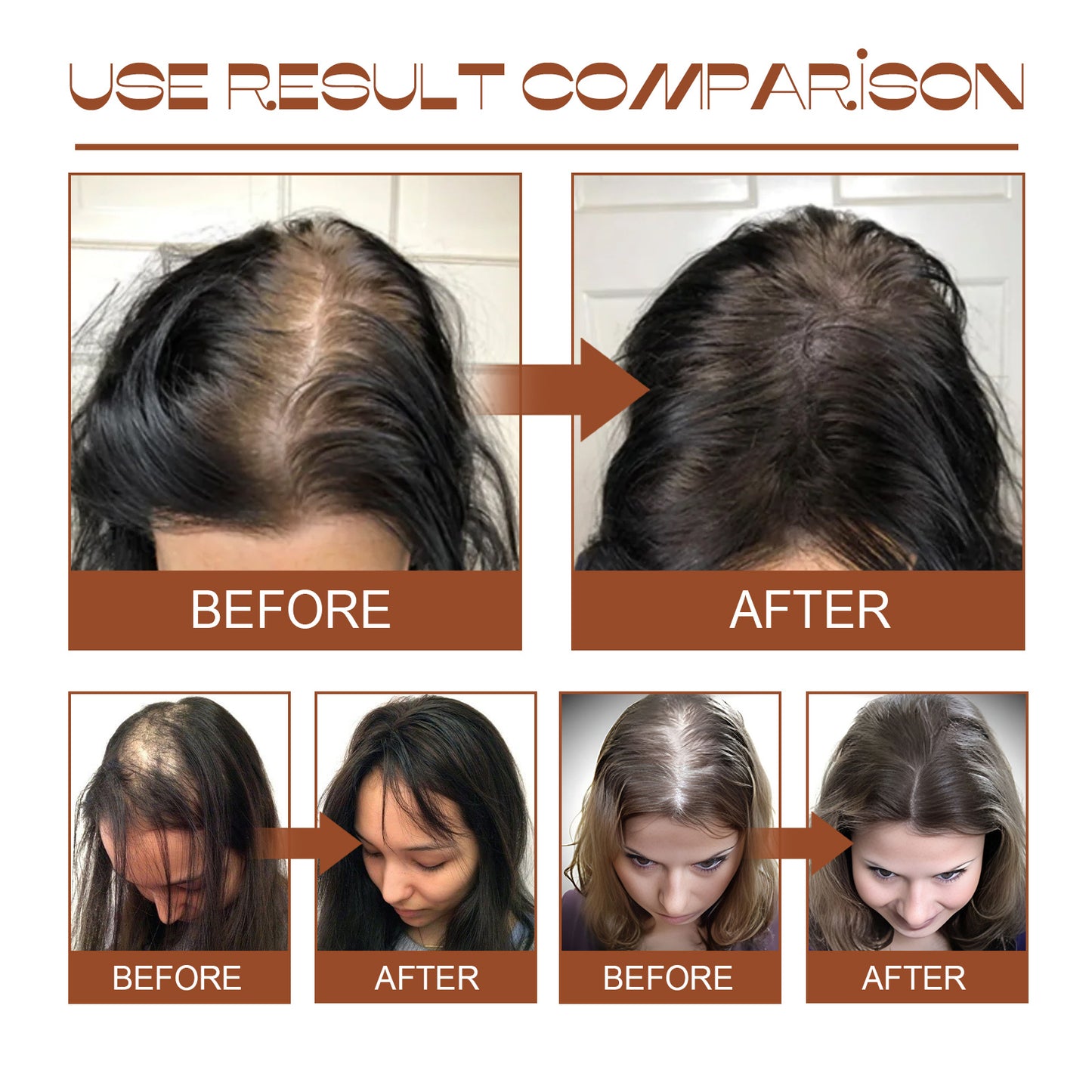 EELHOE Batana Oil Conditioner Moisturizes, Repairs, Strengthens Hair Roots
