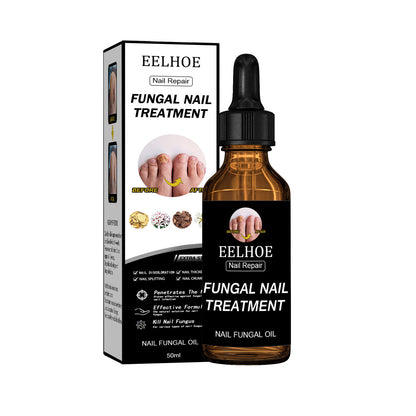 EELHOE Nail Repair Solution, Thickening And Brightening Nail Care Solution