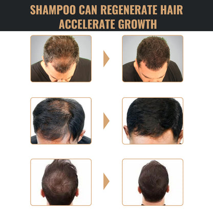 Root Activator Shampoo, Natural Hair Regrowth Shampoos, Unisex Hair Thickening
