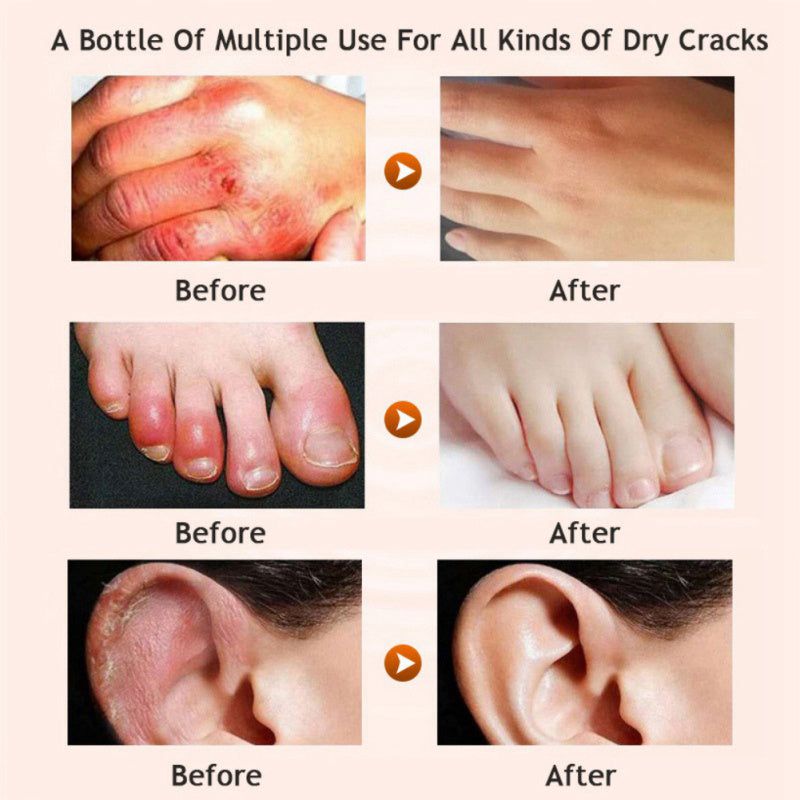 Honey moisturizing cream foot cream set
