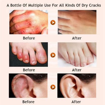 Honey moisturizing cream foot cream set