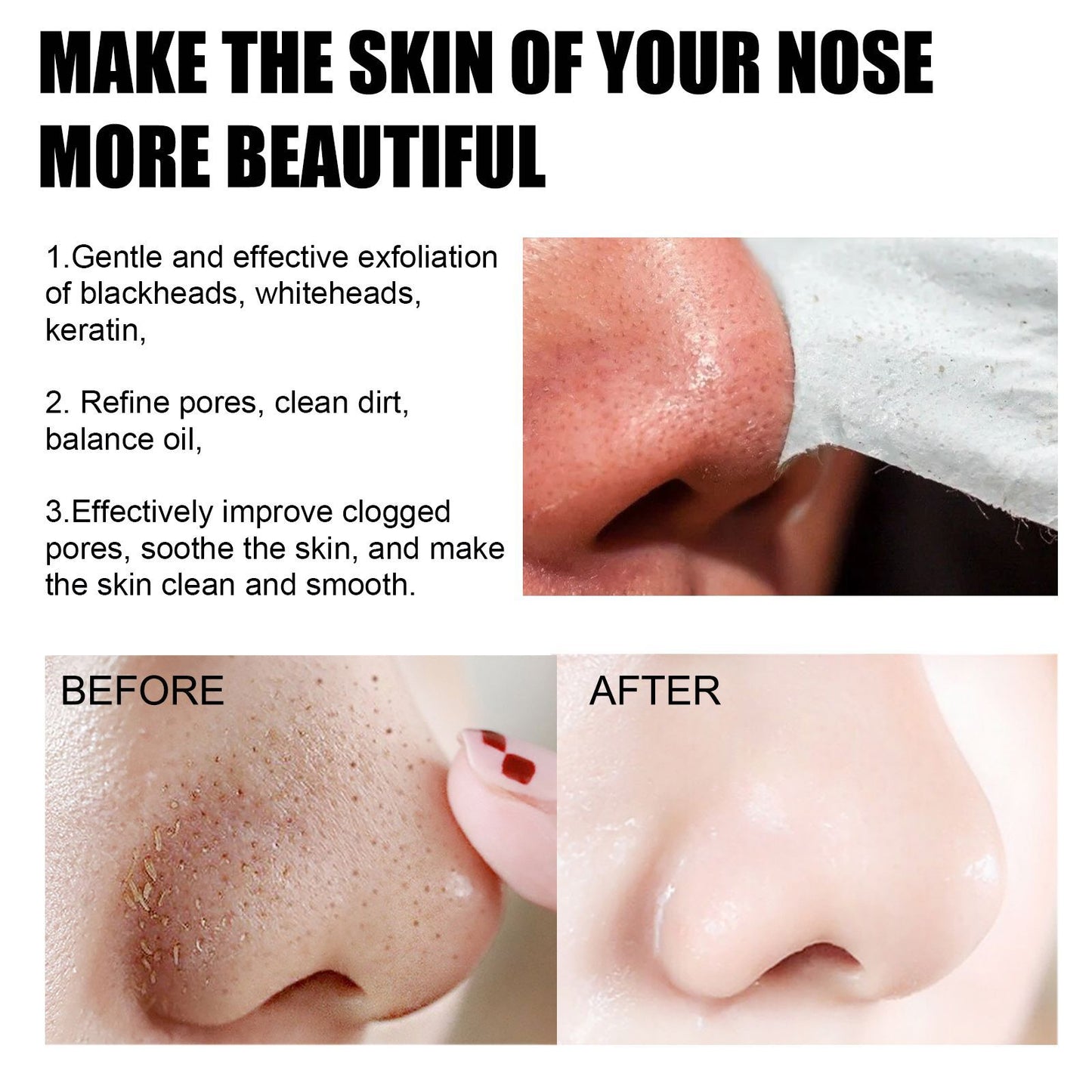 EELHOE Blackhead Removal Nasal Mask Deep Pore Cleansing Blackheads