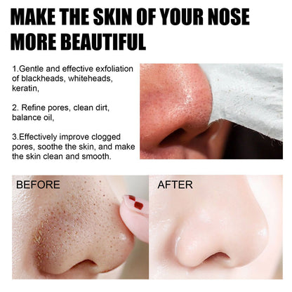 EELHOE Blackhead Removal Nasal Mask Deep Pore Cleansing Blackheads