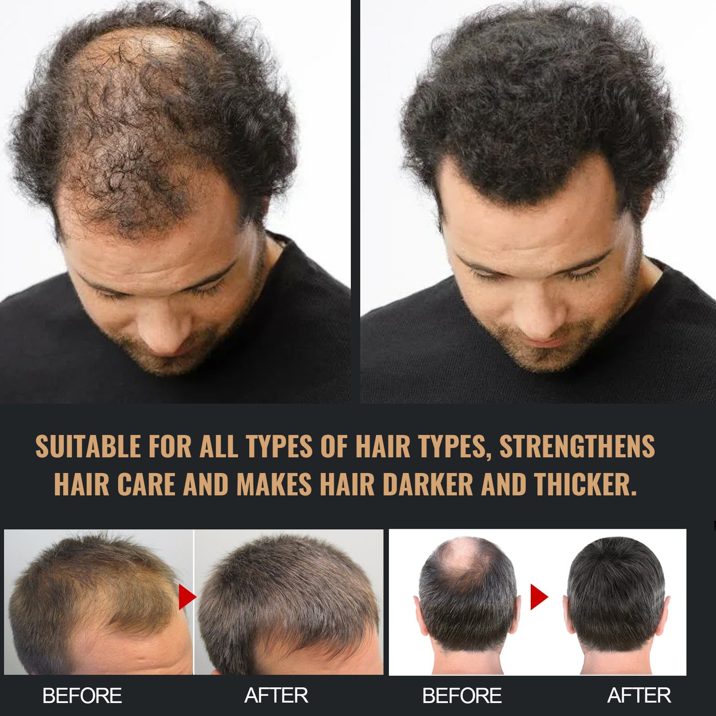 Root Activator Shampoo, Natural Hair Regrowth Shampoos, Unisex Hair Thickening