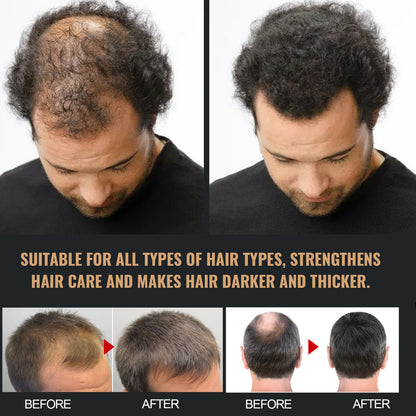 Root Activator Shampoo, Natural Hair Regrowth Shampoos, Unisex Hair Thickening