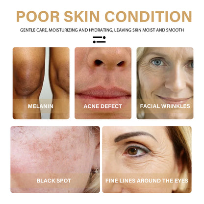 EELHOE Turmeric Dark Spot Correction Face Care Spot Moisturizing UV Protection