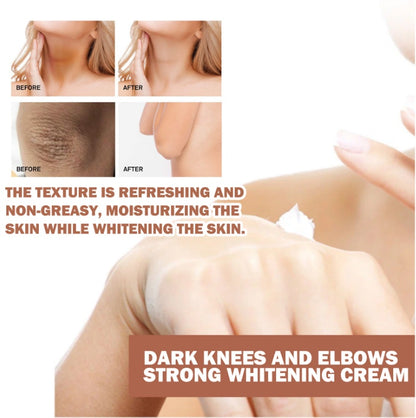 EELHOE Joint Dark Skin Joint & Elbow Repair Cream