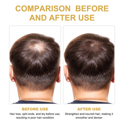 EELHOE Rosemary Hair Treatment Oil
