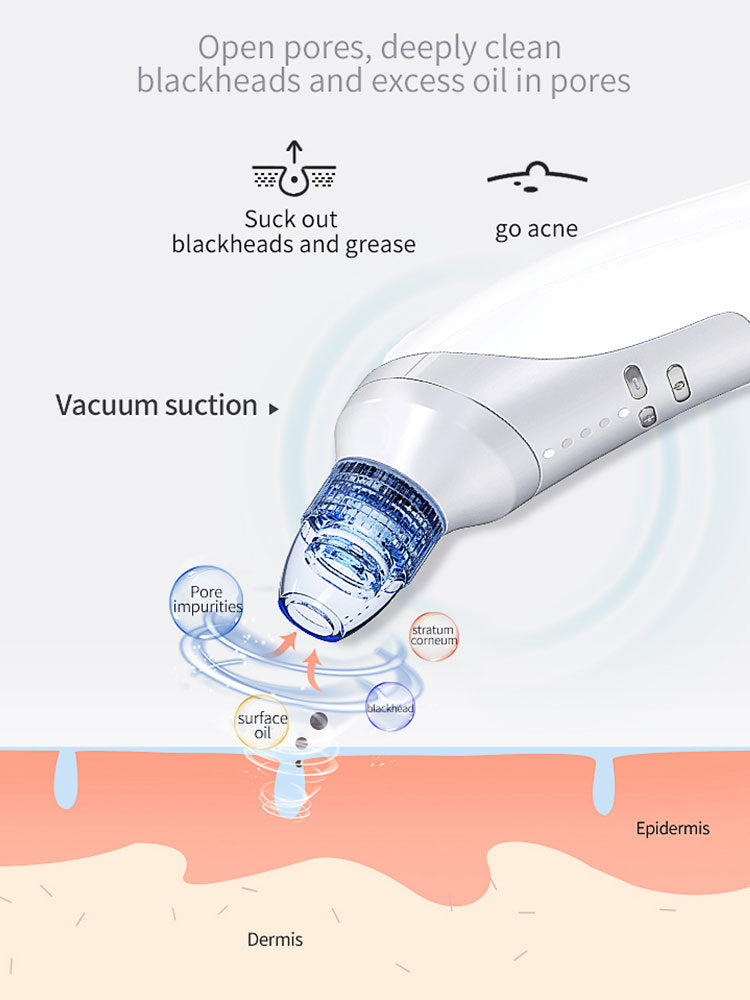 Blackhead Suction Instrument, Electric Blackhead Suction Artifact  Removal